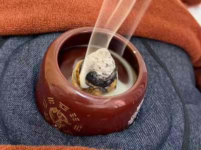 脐灸.jpg